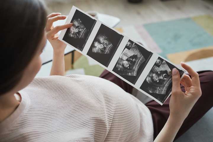AdobeStock_430133132